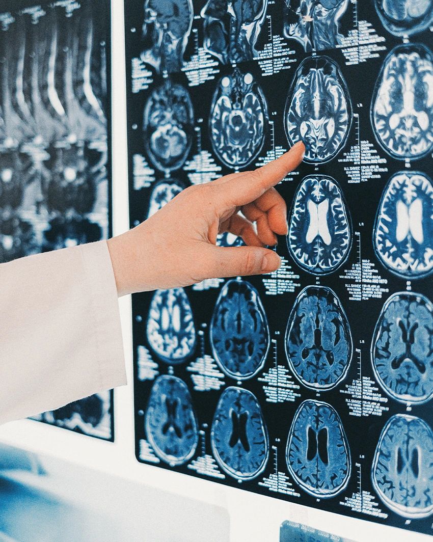 NEUROREHAB